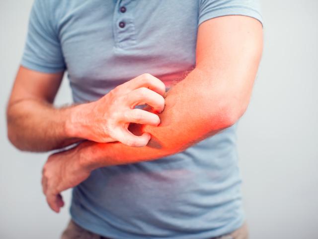 Elbow, itching, Healthcare And Medicine