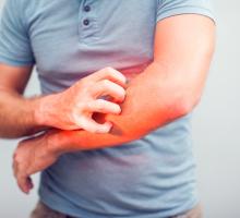 Elbow, itching, Healthcare And Medicine