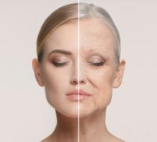 Woman aging skin