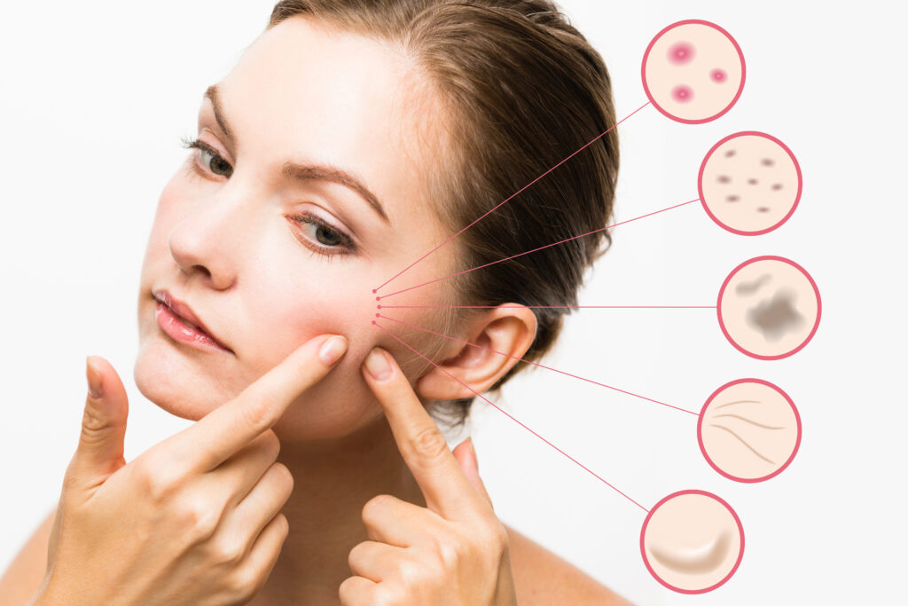 Woman skin conditions