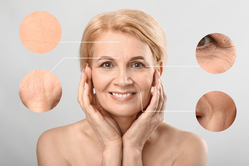 Woman with aging skin