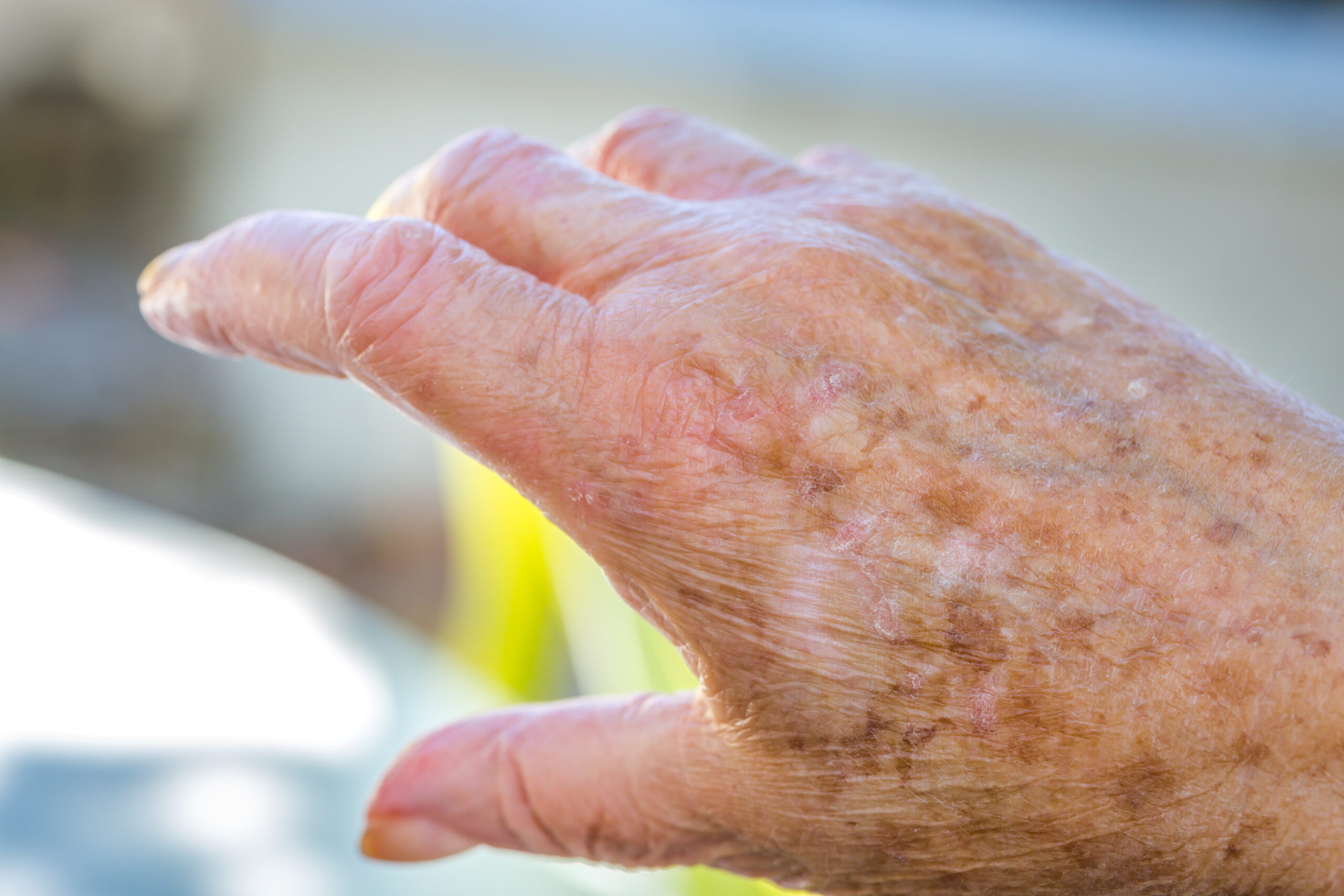 Aging hands