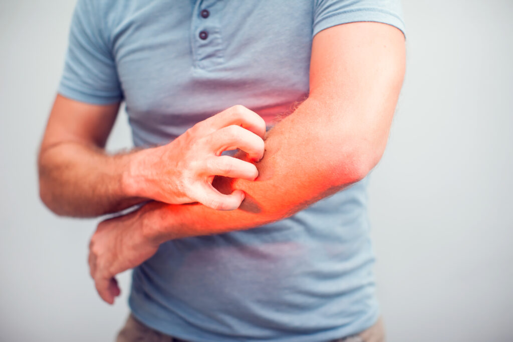 Man scratching arm