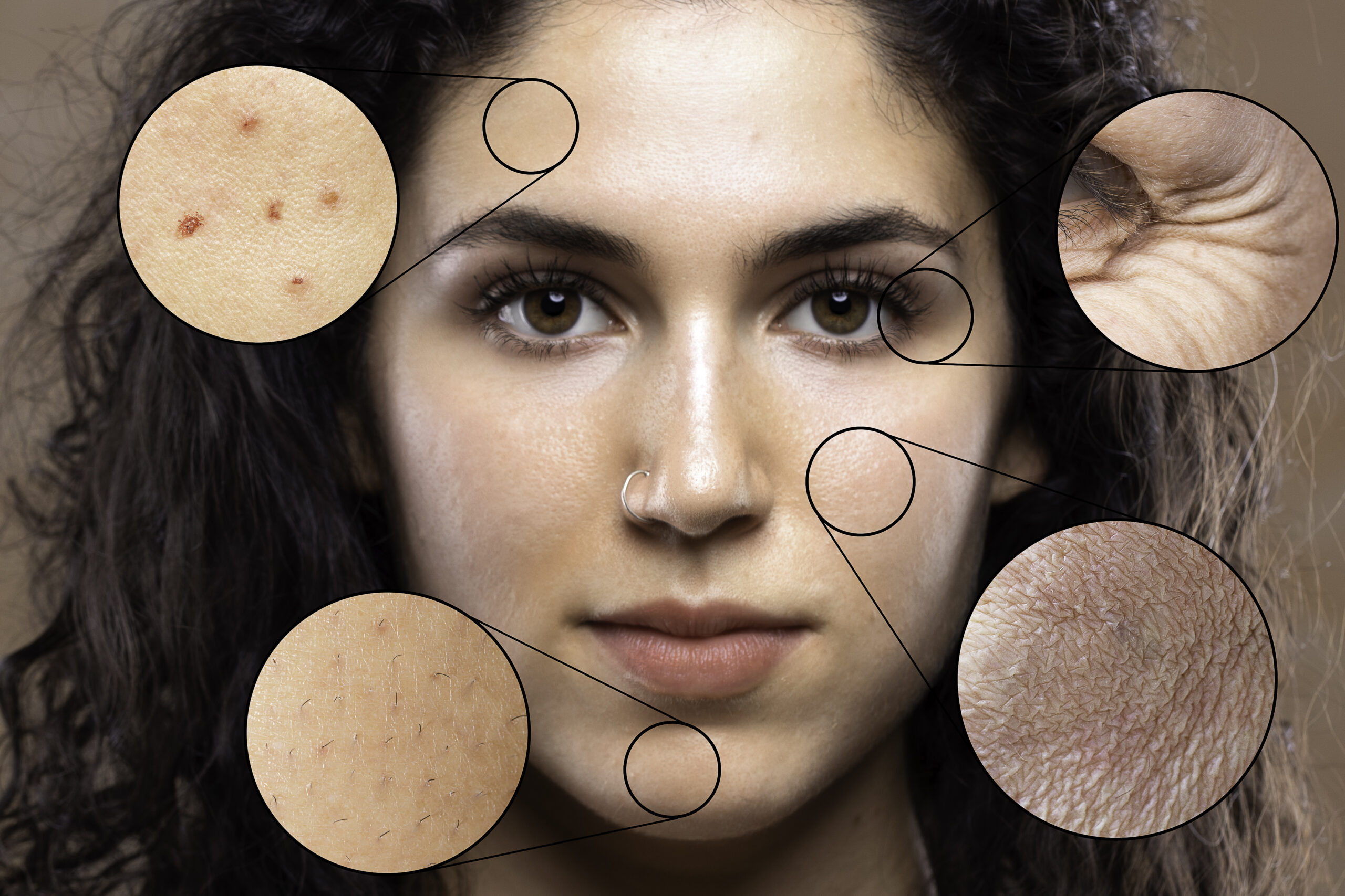 dermatology